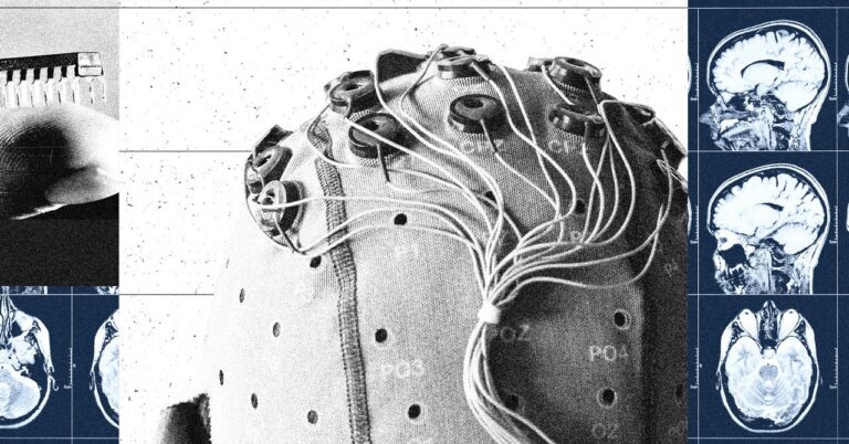 082025_Brain-Computer-Interfaces.jpg