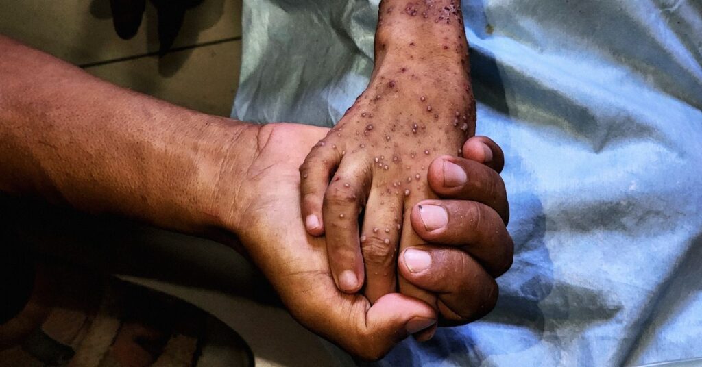 Malnutrition-Gaza-Science-2226867552.jpg
