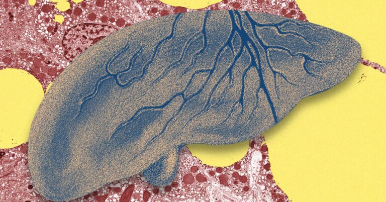 Theres-a-Fatty-Liver-Epidemic-Science.jpg