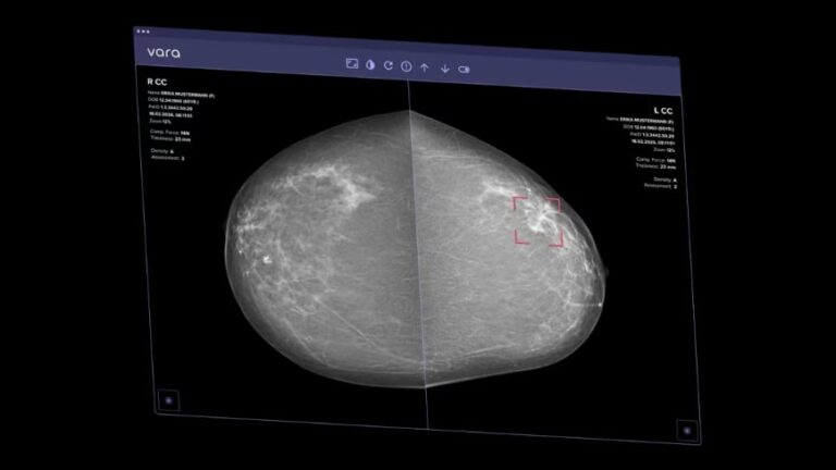 ai-mammogram-2.jpg