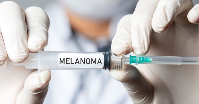 vacuna20melanoma202275195271.jpg